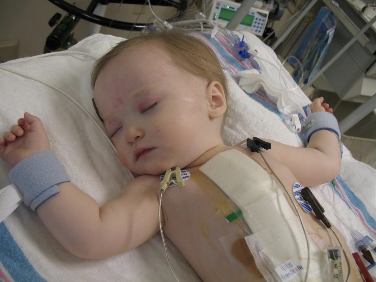 Me, one day after my surgery, under sedation and strapped to the hospital bed.
